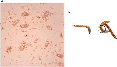 Sequencing to identify pathogens in Tenebrio molitor: Implications in insects farmed for food and feed